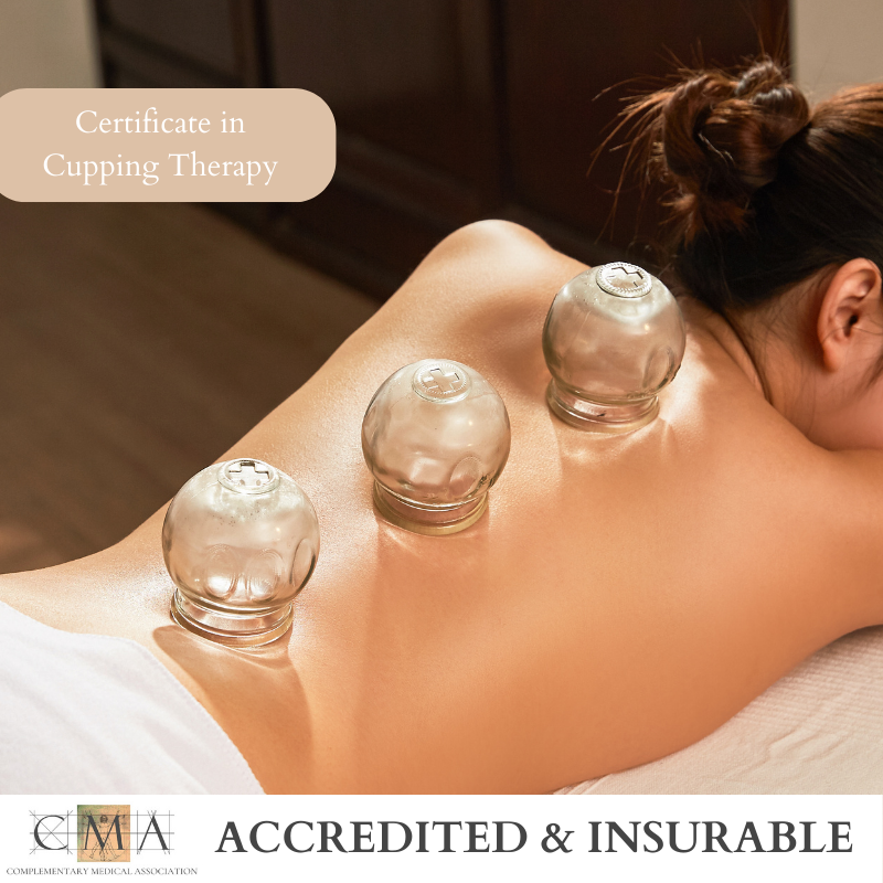 Certificate in Cupping Therapy - 1 Day